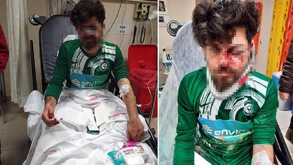 Kırmızı kart gören futbolcu, yerde yatan rakibinin yüzüne tekme atıp yaraladı  - Sputnik Türkiye